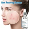 S3a6eaf35bdfb44ddb651420e49a853544.webp 07-Salicylic Acid Solution Essence Shrink Pores and Acne Spot Removing Shrink Pores Oil-Control Brighten Face Skin Makeup