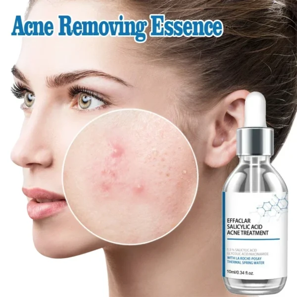 S3a6eaf35bdfb44ddb651420e49a853544.webp 07-Salicylic Acid Solution Essence Shrink Pores and Acne Spot Removing Shrink Pores Oil-Control Brighten Face Skin Makeup