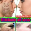 S4c322d96611748249e808c1dad8534d0c.webp 07-Salicylic Acid Solution Essence Shrink Pores and Acne Spot Removing Shrink Pores Oil-Control Brighten Face Skin Makeup