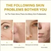S5764c981e6f344ba9fa3b68db60a2d3ci.webp Dilute melanin, acne, 50% TCA, high-quality chemical exfoliation, acidic skin beauty care