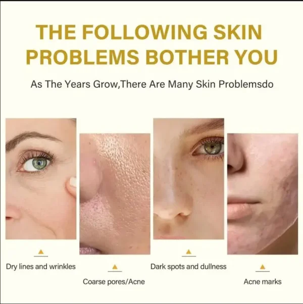 S5764c981e6f344ba9fa3b68db60a2d3ci.webp Dilute melanin, acne, 50% TCA, high-quality chemical exfoliation, acidic skin beauty care
