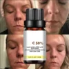 S616d864391834871bb8bee983c8066b6B.webp Dilute melanin, acne, 50% TCA, high-quality chemical exfoliation, acidic skin beauty care
