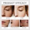 S7201c3726df24c1ab8ed491d67fdc86ei.webp Upgrade Oligopeptide Face Skin Repair Micro Needle Serum Sensitive Skin Moisturizing and Smoothing Hyaluronic Acid Essence