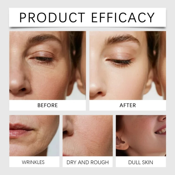 S7201c3726df24c1ab8ed491d67fdc86ei.webp Upgrade Oligopeptide Face Skin Repair Micro Needle Serum Sensitive Skin Moisturizing and Smoothing Hyaluronic Acid Essence