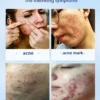 S9b871fd69ae04087a18ba6ccf245db0b0.webp 07-Salicylic Acid Solution Essence Shrink Pores and Acne Spot Removing Shrink Pores Oil-Control Brighten Face Skin Makeup