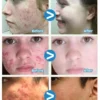 Sad7bf86792754d00997f04b5785f40e0l.webp 07-Salicylic Acid Solution Essence Shrink Pores and Acne Spot Removing Shrink Pores Oil-Control Brighten Face Skin Makeup