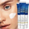 Dark Spot Remover for Face Removing Freckle target hyperpigmentation  age spots sun spot Whitening MOISTURIZING skin beauty care