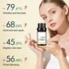 Sd3c8fffe3f8c464985ed1a5a1e6224468.webp Dilute melanin, acne, 50% TCA, high-quality chemical exfoliation, acidic skin beauty care