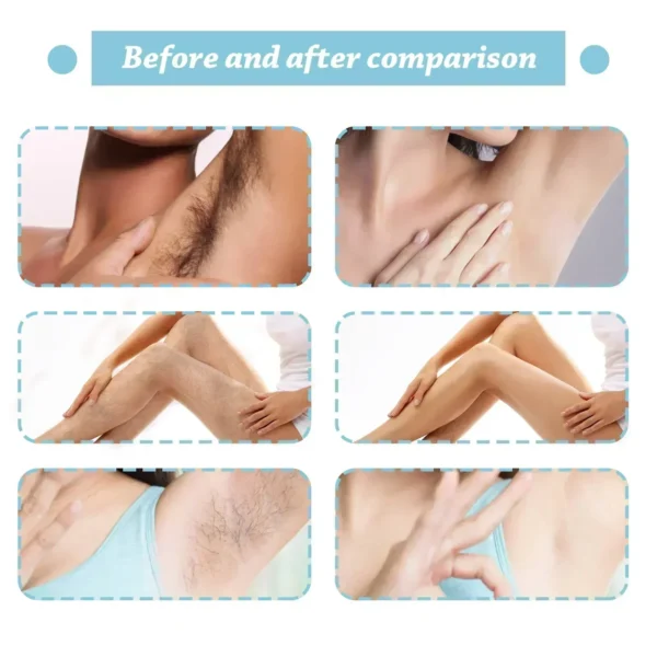 Se50a986d13c3452ba45123229ff5dd5cy.webp Hair Removal Spray Soothing Repairing Delicate Moisturizing Gently Moisturize Prevents Hair Growth For Whole Body